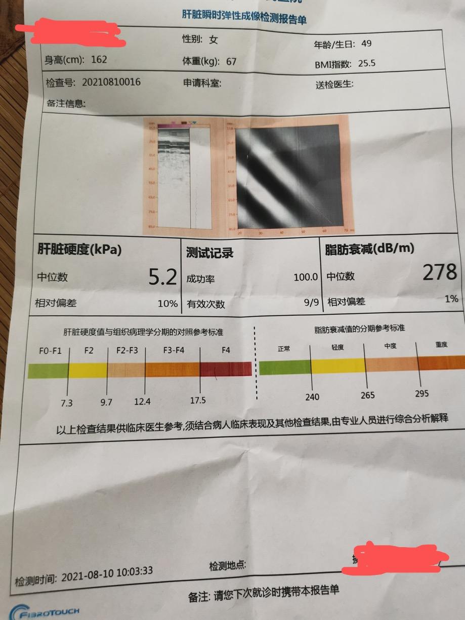 最新肝炎概述与影响分析